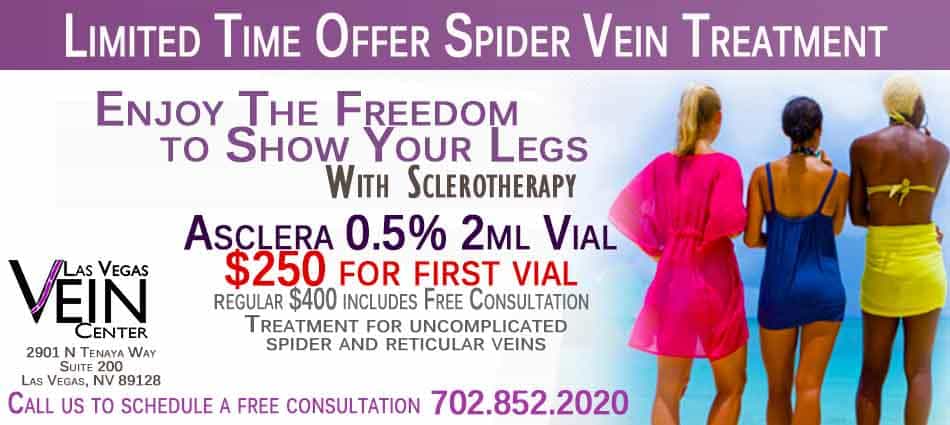 Sclerotherapy Asclera Summer Sale